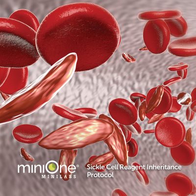 Sickle Cell MiniLab (M3050TAE)
