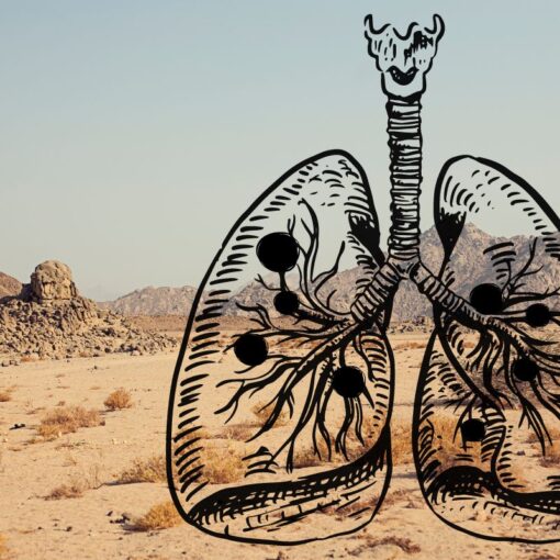 The Fungus Among Us: Valley Fever MiniLab (M3020TAE)